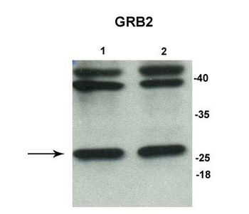 GRB2 Rabbit Polyclonal Antibody