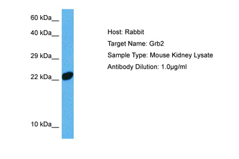 GRB2 Rabbit Polyclonal Antibody