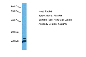 PDGFB Rabbit Polyclonal Antibody