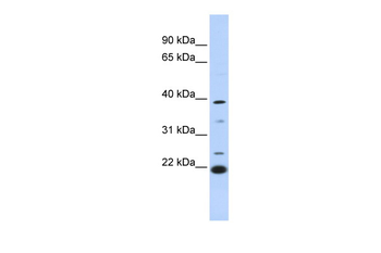 PEF1 Rabbit Polyclonal Antibody