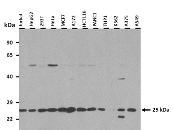 SOD2 Rabbit Polyclonal Antibody