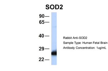 SOD2 Rabbit Polyclonal Antibody