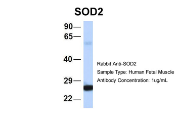 SOD2 Rabbit Polyclonal Antibody