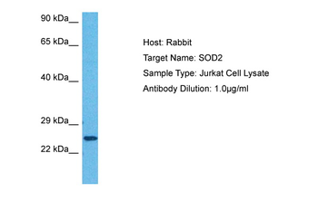 SOD2 Rabbit Polyclonal Antibody