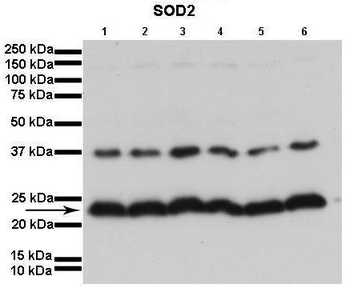 SOD2 Rabbit Polyclonal Antibody