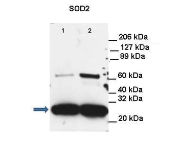 SOD2 Rabbit Polyclonal Antibody