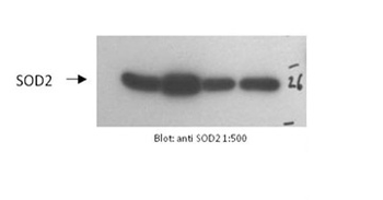 SOD2 Rabbit Polyclonal Antibody