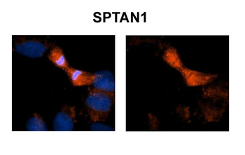 SPTAN1 Rabbit Polyclonal Antibody