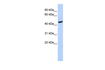 WARS Rabbit Polyclonal Antibody