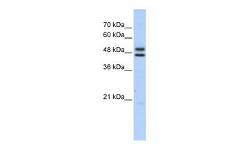 ERCC8 Rabbit Polyclonal Antibody