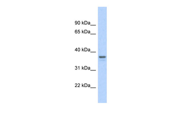 GAPDH Rabbit Polyclonal Antibody