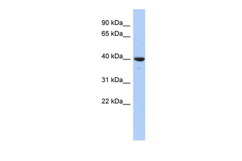 GLRX3 Rabbit Polyclonal Antibody