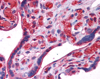 UCHL3 Rabbit Polyclonal Antibody