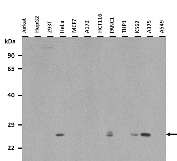 UCHL3 Rabbit Polyclonal Antibody