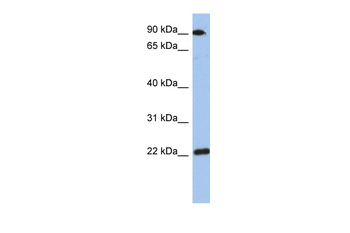 TMED10 Rabbit Polyclonal Antibody