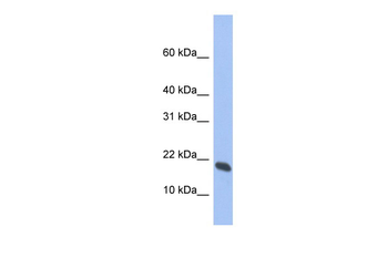 GMFG Rabbit Polyclonal Antibody
