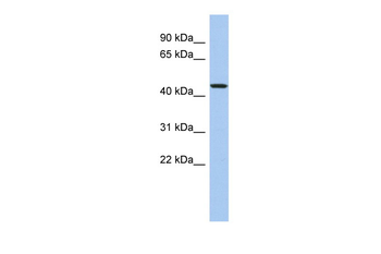 PDCD7 Rabbit Polyclonal Antibody
