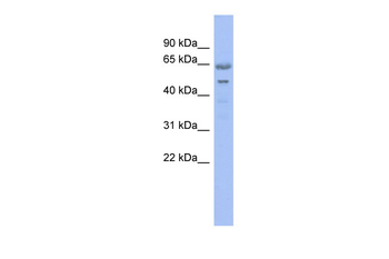 GNL3 Rabbit Polyclonal Antibody