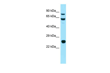 Hsp90ab1 Rabbit Polyclonal Antibody