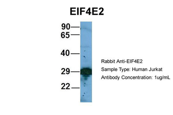 EIF4E2 Rabbit Polyclonal Antibody