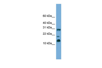 PEA15 Rabbit Polyclonal Antibody