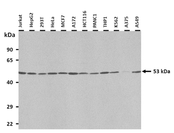 PSEN1 Rabbit Polyclonal Antibody