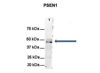 PSEN1 Rabbit Polyclonal Antibody