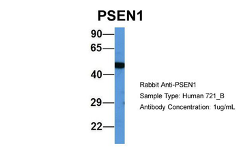 PSEN1 Rabbit Polyclonal Antibody