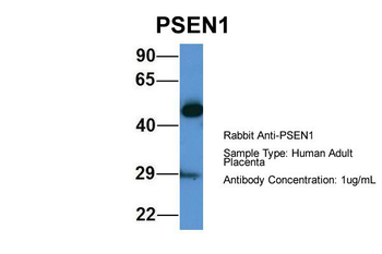 PSEN1 Rabbit Polyclonal Antibody