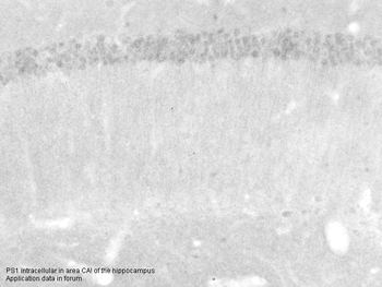 PSEN1 Rabbit Polyclonal Antibody