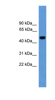 PSEN1 Rabbit Polyclonal Antibody