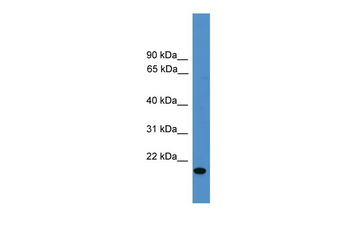 VEGFB Rabbit Polyclonal Antibody