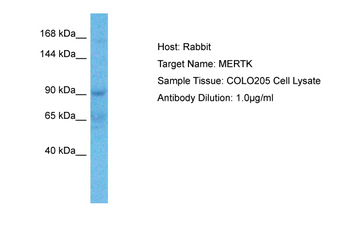 MERTK Rabbit Polyclonal Antibody