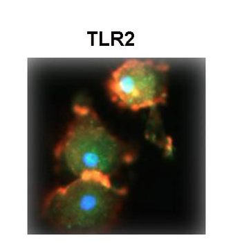 TLR2 Rabbit Polyclonal Antibody