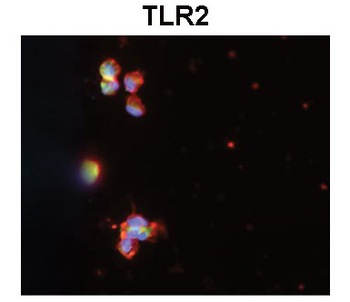 TLR2 Rabbit Polyclonal Antibody