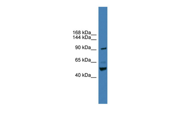 TLR2 Rabbit Polyclonal Antibody