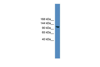 USP7 Rabbit Polyclonal Antibody