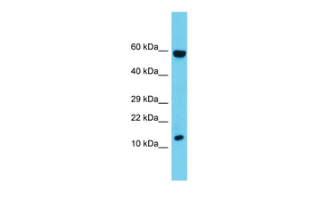 Cd247 Rabbit Polyclonal Antibody