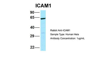 ICAM1 Rabbit Polyclonal Antibody