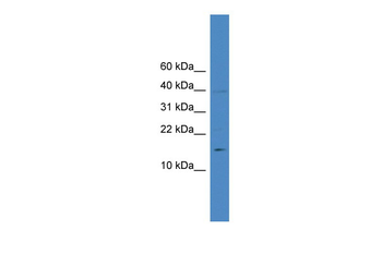 IL17A Rabbit Polyclonal Antibody