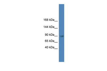 TLR4 Rabbit Polyclonal Antibody