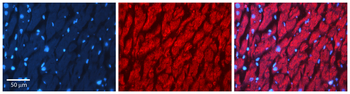 CSTB Rabbit Polyclonal Antibody
