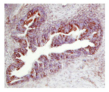 TIMP2 Rabbit Polyclonal Antibody