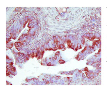 TIMP2 Rabbit Polyclonal Antibody
