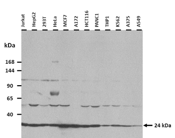 TIMP3 Rabbit Polyclonal Antibody