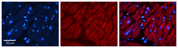 TIMP3 Rabbit Polyclonal Antibody