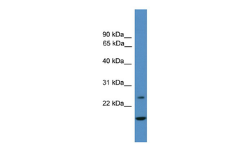 TFPI2 Rabbit Polyclonal Antibody