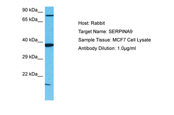 SERPINA9 Rabbit Polyclonal Antibody