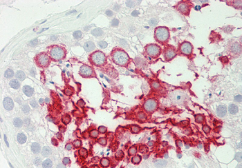 COPS6 Rabbit Polyclonal Antibody