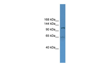 UBA6 Rabbit Polyclonal Antibody